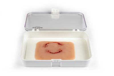 Wound moulage "human bite"