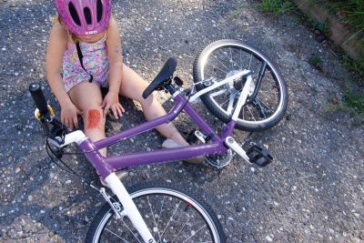 Wound moulage "abrasion"