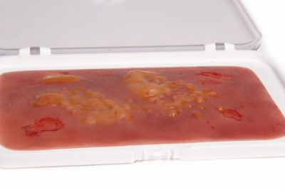 Wound moulage 2nd degree burn