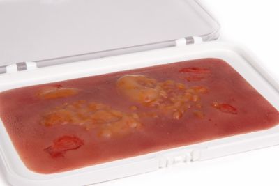 Wound moulage 2nd degree burn