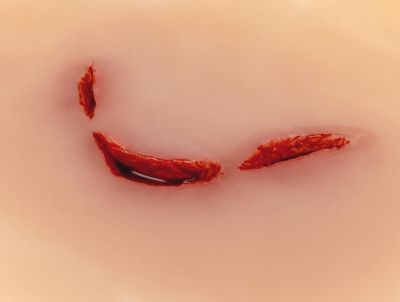 Wound moulage cut broken bottle