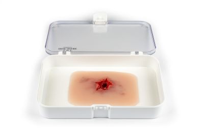 Wound moulage bullet exit hole