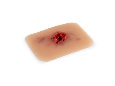 Wound moulage bullet exit hole