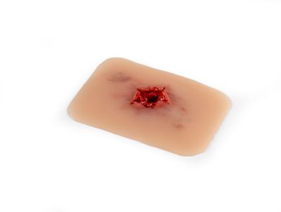 Wound moulage bullet exit hole