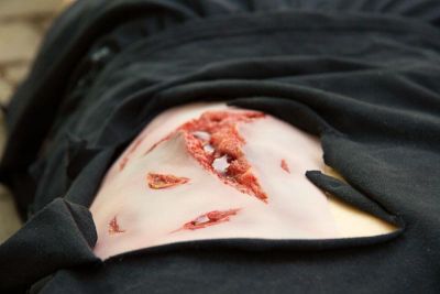 Wound moulage laceration, large with bleeding function
