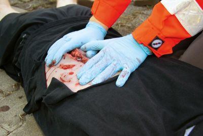 Wound moulage laceration, large with bleeding function