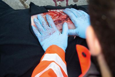 Wound moulage laceration, large with bleeding function