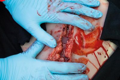 Wound moulage laceration, large with bleeding function