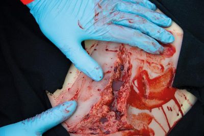 Wound moulage laceration, large with bleeding function