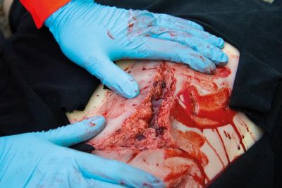 Wound moulage laceration, large with bleeding function