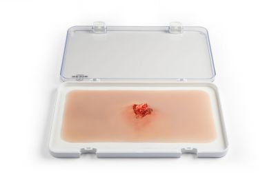 Wound moulage open fracture, arm bone with bleeding function