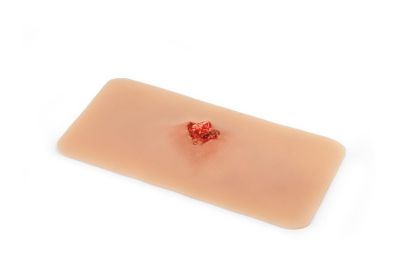 Wound moulage open fracture, arm bone with bleeding function