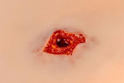 Wound moulage bullet hole, leg with bleeding function