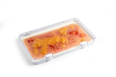 Wound moulage 2nd degree burn