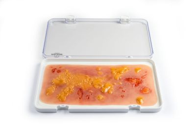 Wound moulage 2nd degree burn