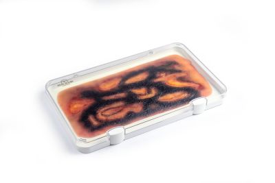 Wound moulage 3rd degree burn