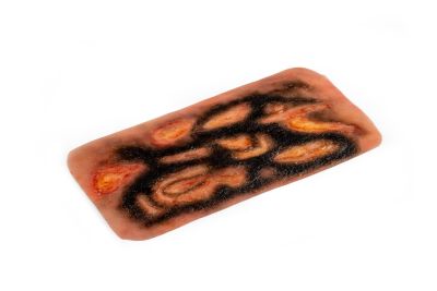 Wound moulage 3rd degree burn
