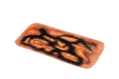 Wound moulage 3rd degree burn