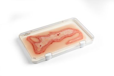 Wound moulage scalding