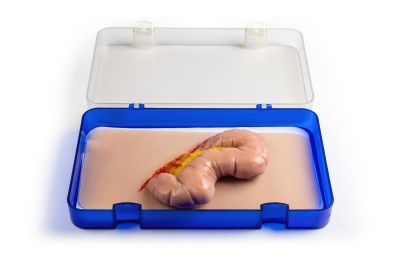 Wound moulage protrusion of large intestines
