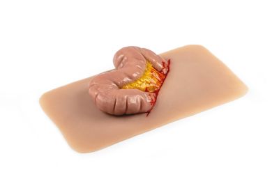 Wound moulage protrusion of large intestines