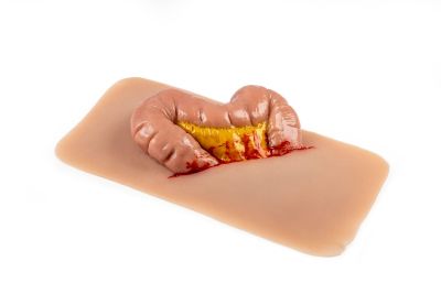 Wound moulage protrusion of large intestines