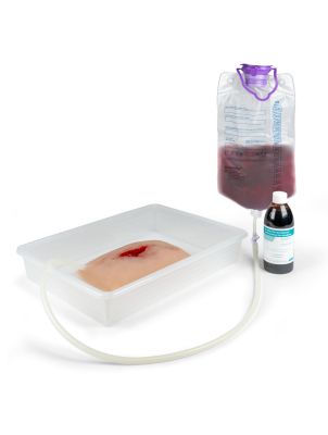 Wound moulage wound packing