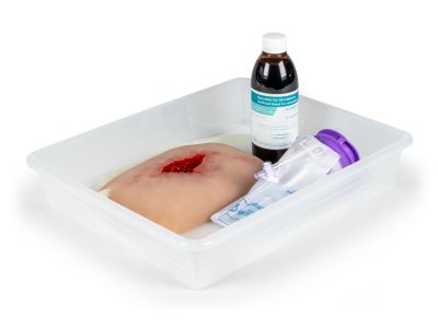 Wound moulage wound packing