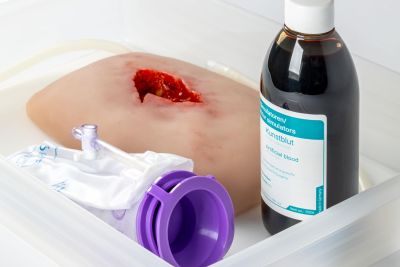 Wound moulage wound packing