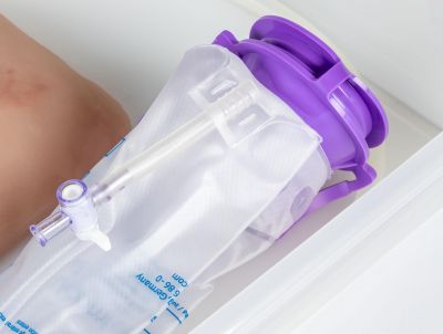 Wound moulage wound packing