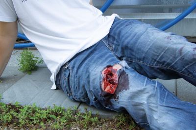 Wound moulage wound packing