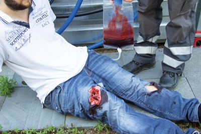 Wound moulage wound packing