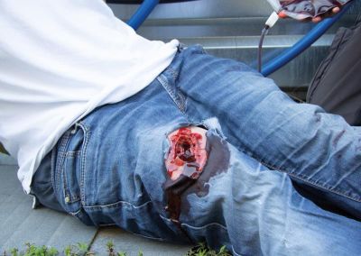 Wound moulage wound packing