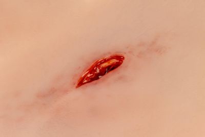 Wound moulage Stab wound with bleeding function
