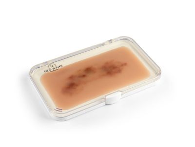 Wound moulage hematoma fresh