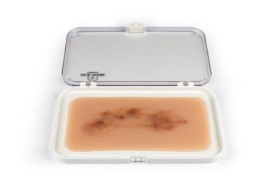 Wound moulage hematoma fresh