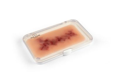 Wound moulage Hematoma older