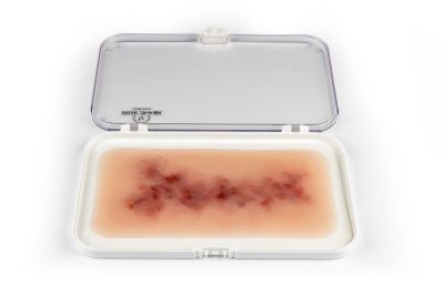 Wound moulage Hematoma older