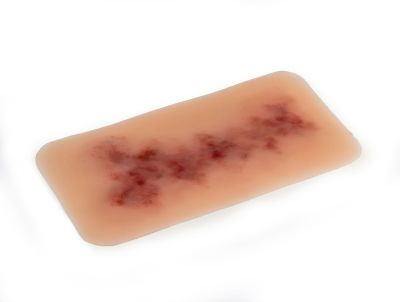Wound moulage Hematoma older