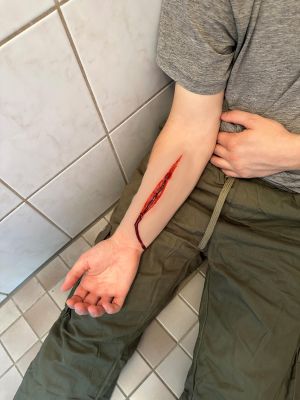Wound moulage Suicide attempt