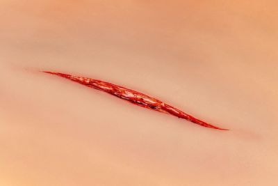 Wound moulage Throat Cut