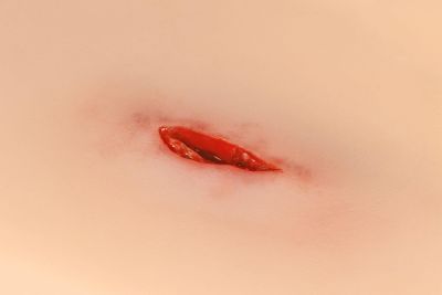 Wound moulage Stab wound neck