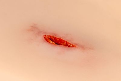 Wound moulage stab thigh