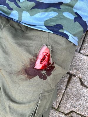 Wound moulage stab thigh