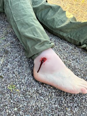 Wound moulage shot ankle joint