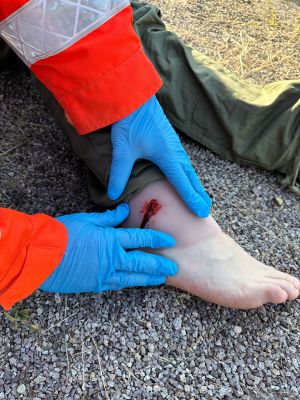 Wound moulage shot ankle joint