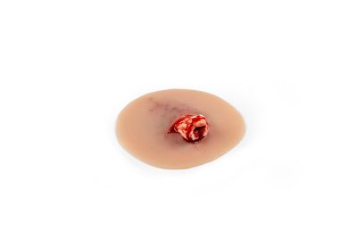 Wound presentation open fracture ankle joint