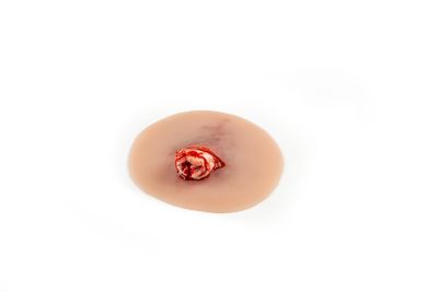 Wound presentation open fracture ankle joint