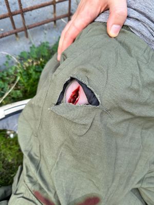 Wound moulage stab groin, Wound Packing