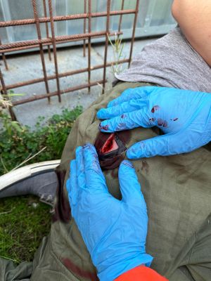 Wound moulage stab groin, Wound Packing